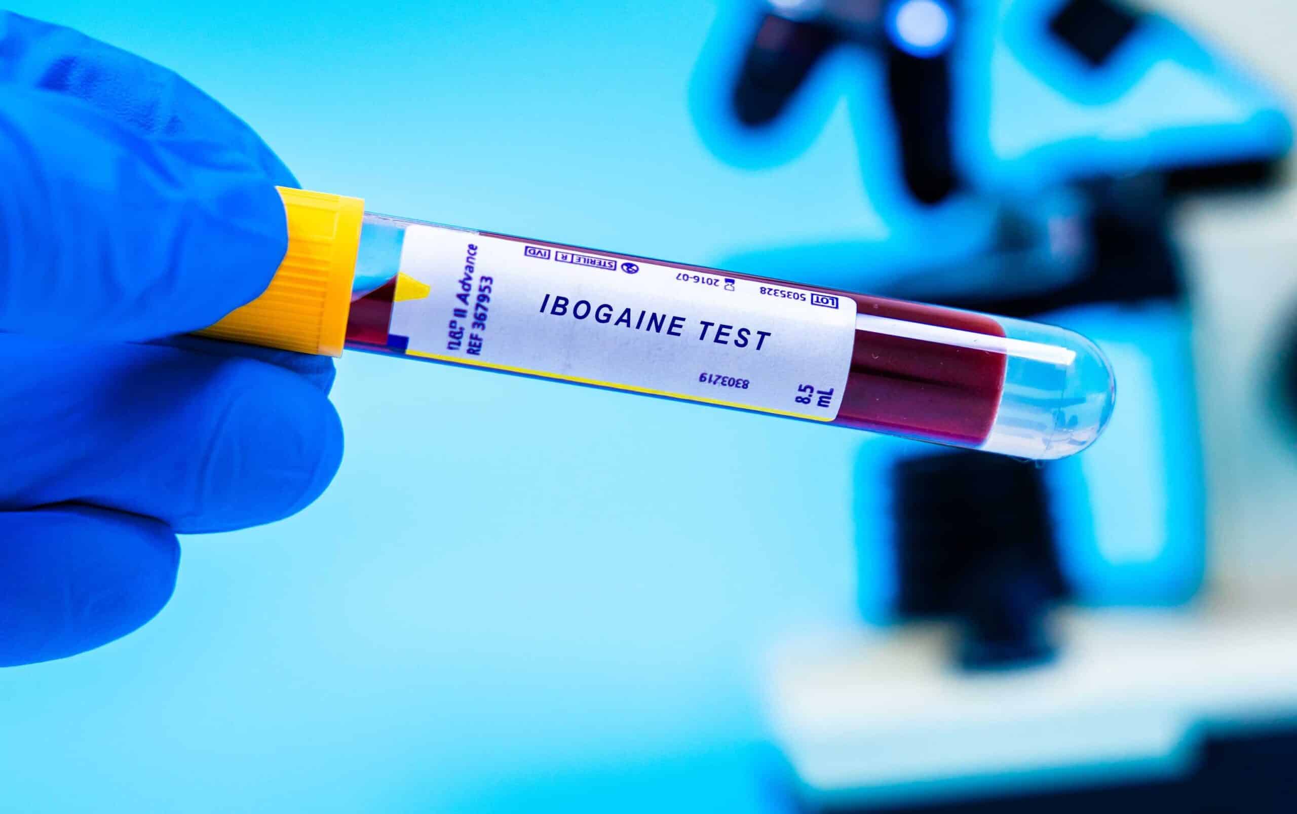 The First 90 Days After Ibogaine: A Recovery Integration Roadmap